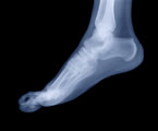 Orland Podiatrist